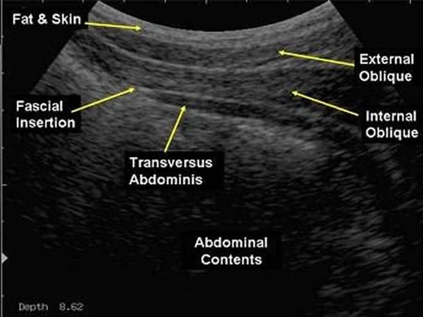 Ultrasound4